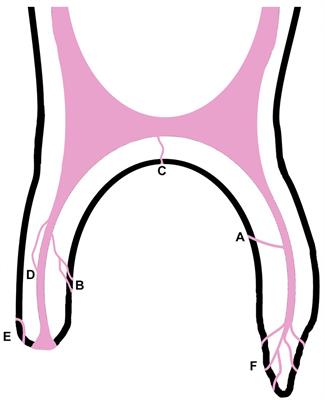 Micro-CT and histological examination of accessory canals in 34 equine cheek teeth